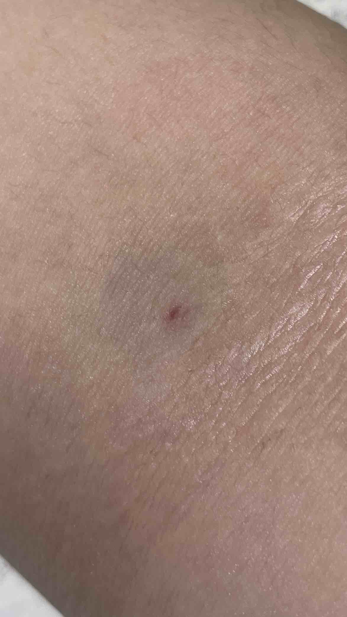 제 버킷리스트였던 헌혈을 오늘 처음 했습니다 ㅎㅎ
내년이면 성분헌혈도 가능하다니 빨리 생일이 지나갔음 좋겠다는 생각이 드네여..ㅎㅎ 
저도 100번 200번 헌혈하고 싶어요!! 어서 빨리 8주가 지나고 다시 헌혈 할 수 있는 기회가 왔음 좋겠네요..
아 그리고 ABO프렌즈 가입하고 싶은데 그냥 동네 헌혈의 집 찾아가면 되는건가요?