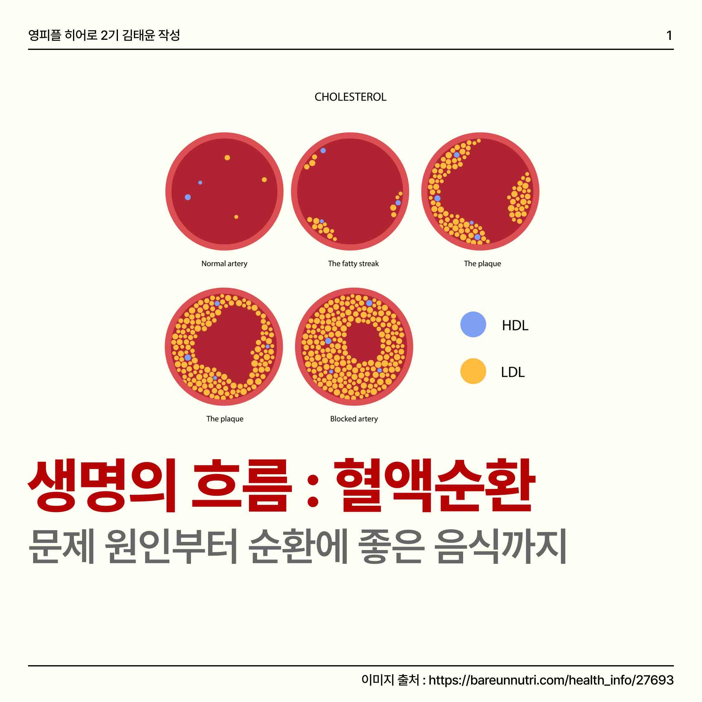 오늘은 혈액순환의 원인과 순환이 잘 되게 도와주는 음식들에 알아보려 합니다!🧚🏻

요즘 날씨가 점점 추워져 겨울이 다가오는 것이 몸소 느껴지는데요. 이런 추운 날 특히 혈액순환 장애가 생기기 쉽다고 합니다!😢😨 우리 몸의 체온이 떨어지면 혈관 수축으로 심장의 혈류량이 떨어져 혈액의 순환이 원활하지 않게 돼요🤯
고혈압, 고지혈증 등의 질환을 앓고 있거나 콜레스테롤 수치가 높은 경우 혈액순환 장애가 나타나기 쉬우니 운동으로 예방해요!🏃🏃‍♀️

⭐️혈액순환에 좋은 음식 5가지⭐️

1. 다시마 : 다시마는 혈액순환을 좋게 하고 피를 맑고 깨끗하게 하는 비타민 𝓬와 𝓮, 알긴산 등이 들어있습니다!
2. 꽁치 : 꽁치에는 불포화지방산인 𝓮pa와 𝓭𝓱a가 풍부해 혈관 확장 및 나쁜 콜레스테롤과 혈중 중성지방 농도를 낮춰줍니다.
3. 단호박 : 단호박에 있는 베타카로틴은 혈전을 만드는 것을 막아주고, 심근경색의 위험을 낮춰줍니다.
4. 해바라기씨 : 해바라기씨에는 콜레스테롤 수치를 낮춰주고 심장 건강에 좋은 식품성 스텔로 성분인 ‘피토스테롤’이 풍부합니다.
5. 보리 : 보리에는 식이섬유로서 베타글루칸의 함량이 높아 체내 혈중 콜레스테롤치를 저하시켜줍니다.



https://www.instagram.com/p/CzgN1kQy7nO/?igshid=eGM1cHl5ZzhuaWQy

https://m.blog.naver.com/gad05093/223262084742